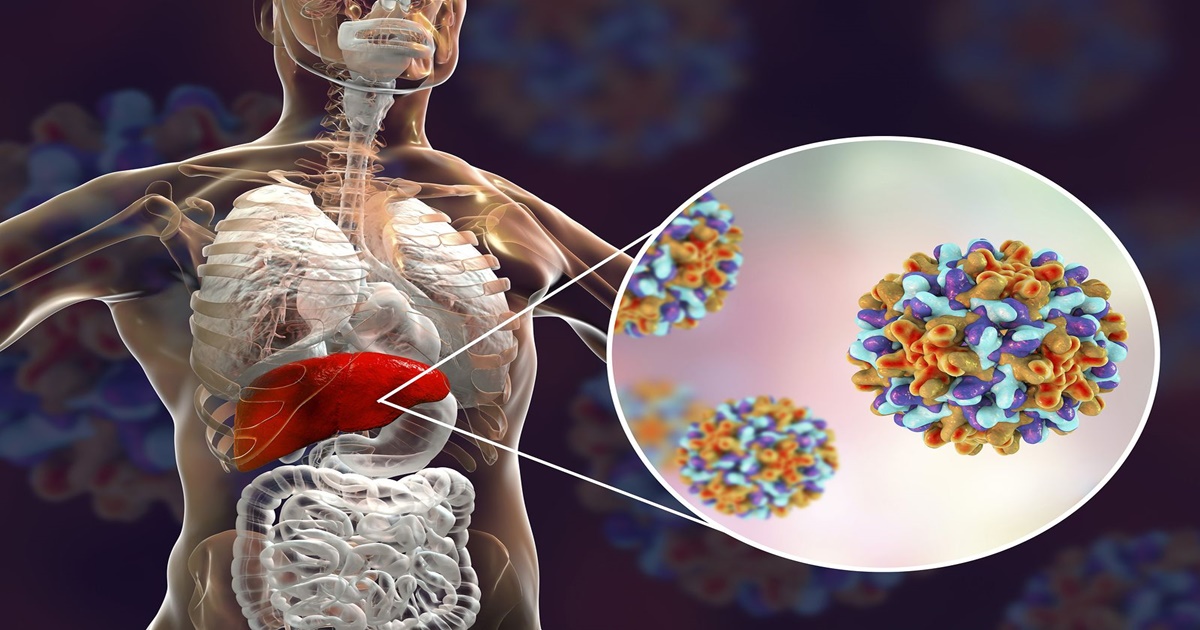 Hepatite B Sintomas Causas E Tratamentos